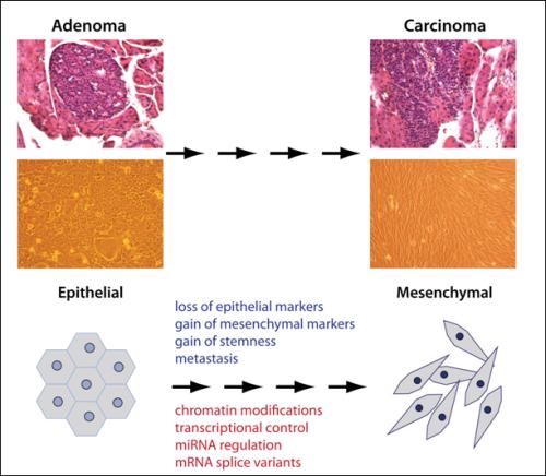 Klasifikace nádorů II - podle typu buněk (tkání), ze kterých nádorová buňka vzniká karcinomy nádory epiteliálních buněk (asi 80-90% lidských nádorů) sarkomy pevné nádory pojivových tkání svalů,