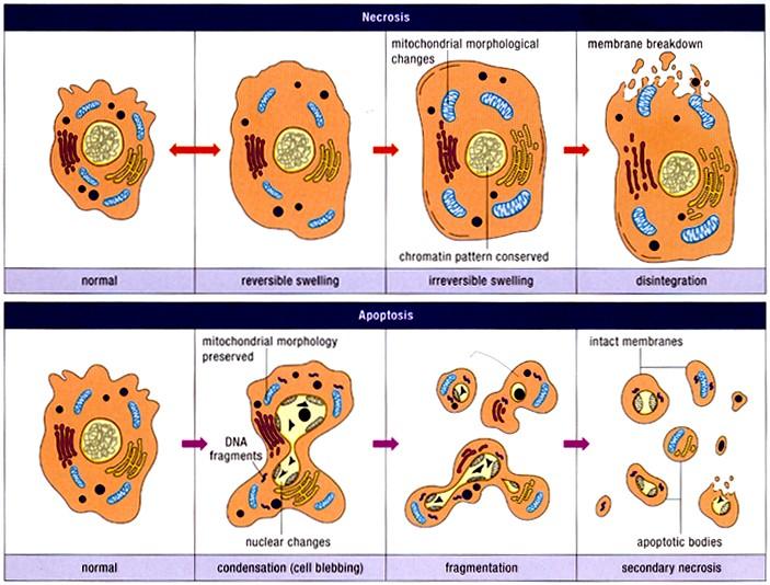 Nekróza vs. apoptóza Nekróza: týká se skupiny postižených buněk vyvolána nefyziologickým poškozením (virová infekce, hypotermie, hypoxie, metabolické jedy,.