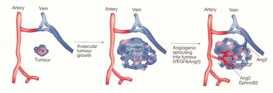 Význam angiogeneze v rozvoji nádorového onemocnění Angiogeneze má klíčový význam