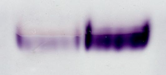 Aktivita NAD+ GDH [µmol.min -1.