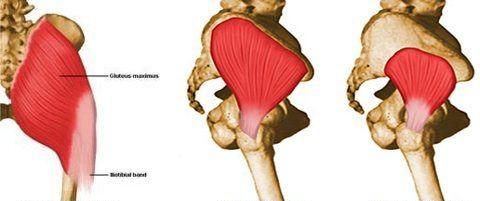 2.7 Svaly dolní končetiny (musculi membri inferioris) Svaly kyčelního kloubu (musculi coxae) Bedrokyčelní sval (musculus iliopsoas) Origo: bederní páteř, jáma kyčelní Insertio: malý