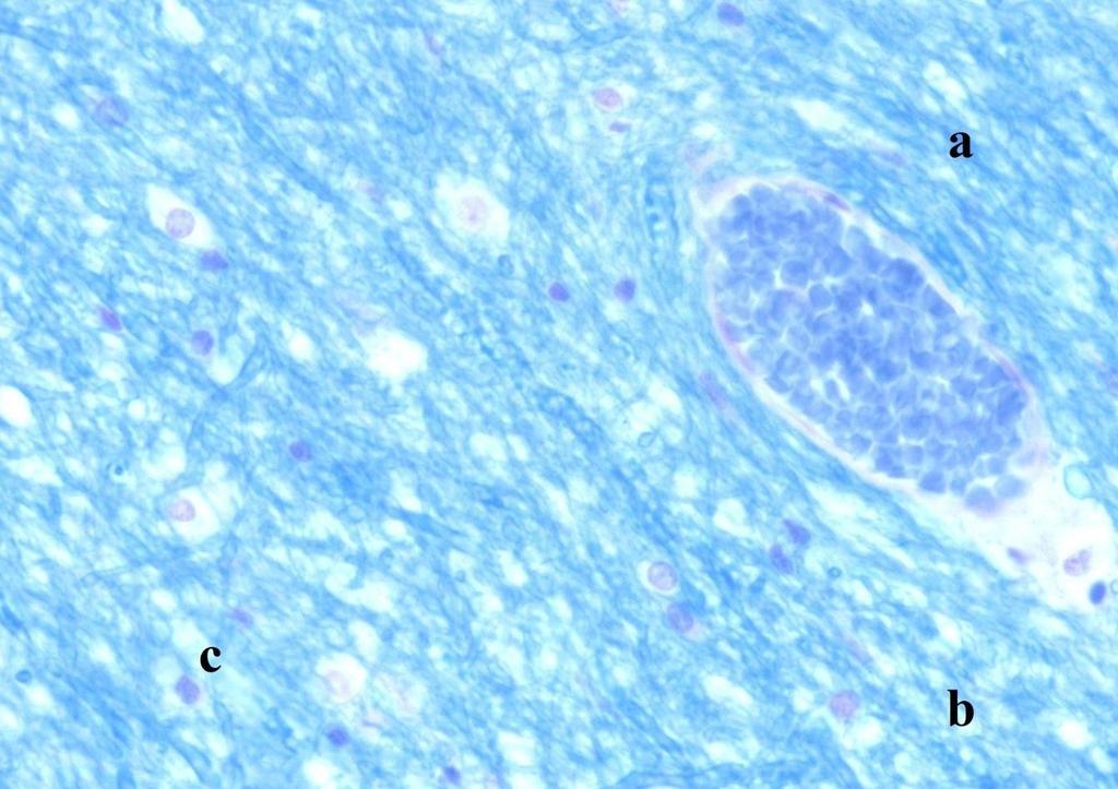 5.4 Koncový mozek (barvení luxolovou modří) Obrázek 18 - Preparát koncového mozku (Barvení luxolovou modří). Zvětšeno 40.