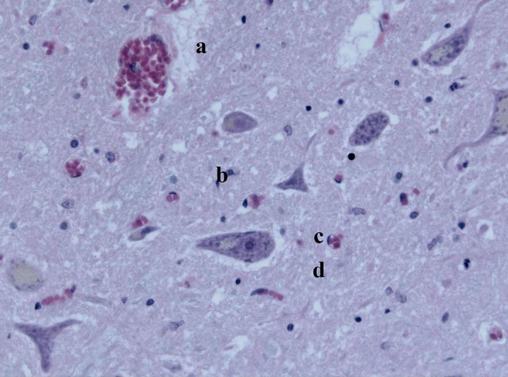 5.10 Hřbetní mícha (Hematoxylin-eosin) Obrázek 24 - Preparát hřbetní míchy (Hematoxylin-eosin). Zvětšeno 40.