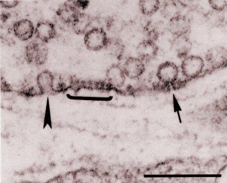 Endosomy endosomy: membránové váčky (Ø 20-150 nm) vstup do