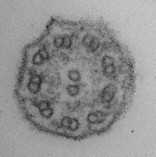 Řasinky - délka 7-10 µm, tloušťka 0,25 µm -