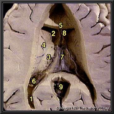 1-ventriculus lateralis cornu post 2- ventriculus lateralis cornu ant 3- thalamus lamina affixa 4-nucleus