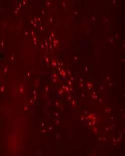 absorbance (570nm) Department of Nonwovens and Nanofibrous Materials NANOFIBROUS WOUND DRESSINGS In vitro tests - cytotoxicyty, biocompatibility Cells