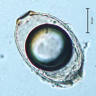 číslo: 100 Druh: Capillaria sp.