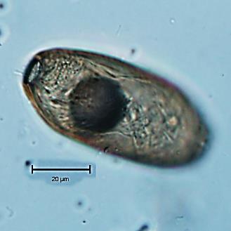 džungarský Evidenční číslo: 75 Druh: Capillaria sp.