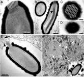 Pithovirus sibericum