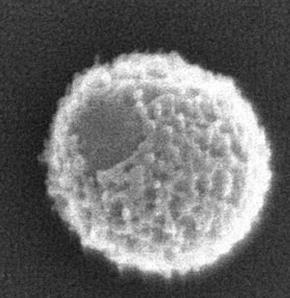 Mollivirus sibericum Izolace v permafrostu na Sibiři Velikost: 500 nm Genom: Lds