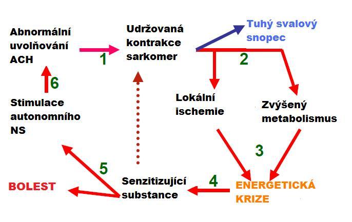 Obrázek č. 3.: Ucelená hypotéza patogeneze MTrP (Simons et al., 2002) Nedostatek ATP, které za normálních okolností inhibuje ACH, způsobí jeho další zvyšování.