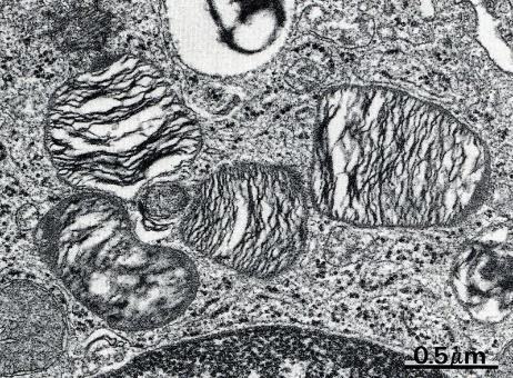 Alveolární výstelka pneumocytus typus I (membranózní pneumocyt, I.