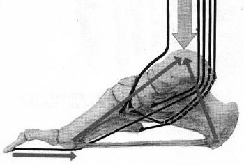 2.1.6 KLENBA NOŽNÍ Klenba nožní zabraňuje nadměrnému stlačování měkkých tkání, čili svalů, cév a nervů při stoji a umožňuje pružnost nohy při chůzi, je sklenuta tak, že se chodidlo opírá o podložku