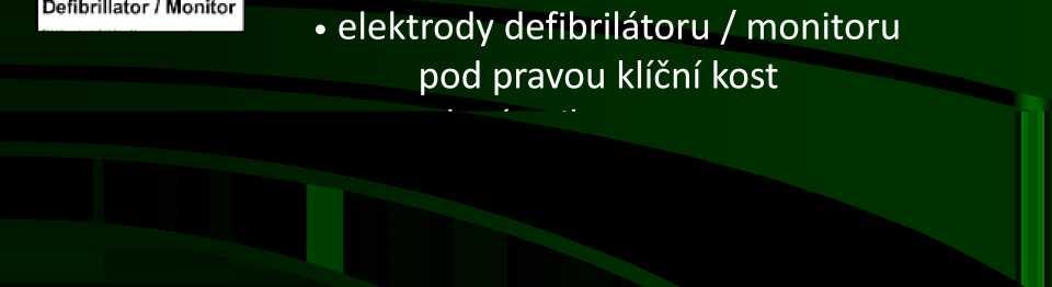 1. Základní neodkladná resuscitace dětí 2. Ventilace / oxygenace 3. Žilní / intraoseální přístup 4.