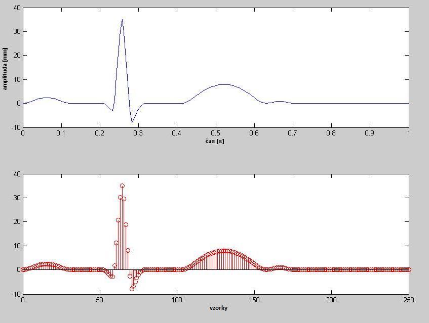 Tabulka 3.1: Parametry modelu EKG Index (i) P Q R S T čas [s] -0,2-0,05 0 0,05 0,3 Θ i [rad] -1/3π -1/12π 0 1/12π 1/2π a i 1,2-5 30-7,5 0,75 b i 0,25 0,1 0,1 0,1 0,4 3.