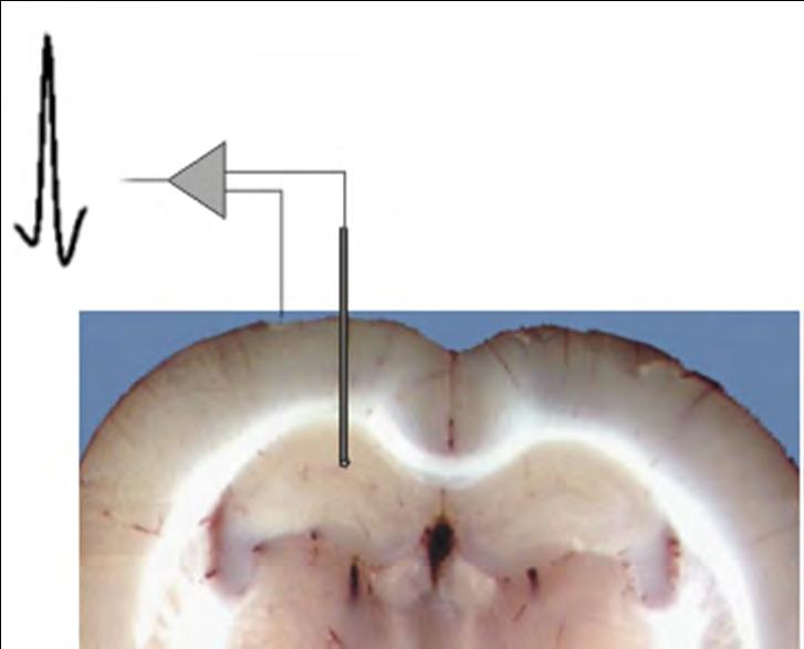 BUŇKY MÍSTA Pyramidové neurony v