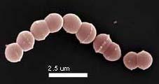 1.3 Streptococcus thermophilus 1.3.1 Morfologie buněk a kolonií Streptococcus thermophilus tvoří ovoidní grampozitivní buňky o průměru 0,7 až 0,9 μm v párech až dlouhých řetízkách (až 50 buněk) [9].