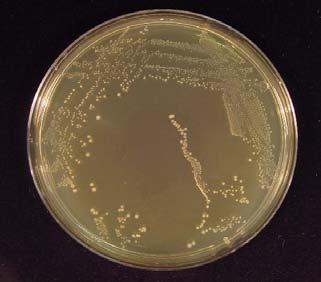Na pevném agarózovém médiu vytváří drobné bílé kolonie (viz obrázek 1.4). Obr. 1.3: Mikroskopický snímek bakterie Streptococcus thermophilus tvořící páry a řetízky [21]. Obr. 1.4: Mikroskopický snímek růstu kolonií na pevném agarózovém médiu bakterie Streptococcus thermophilus [20].