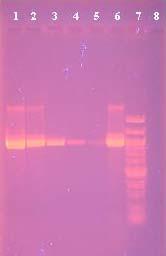 4.2.4 Optimalizace PCR reakce pro kmen Streptococcus thermophilus CCM 4757 Množství použitých primerů Sterm 1 a Sterm 2 bylo 0,5 μl a DNA matrice 1 μl.