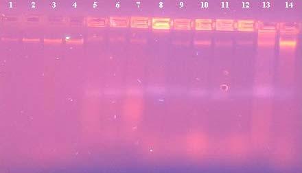 4.3 Identifikace bakterií druhu Streptococcus thermophilus ve vybraných mléčných výrobcích pomocí PCR 4.3.1 Lyze buněk izolovaných z mléčných výrobků U náhodně vybraných 10 různých mléčných výrobků o různém obsahu tuku zakoupených v prodejní síti (tabulka 3.