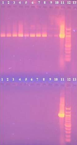 Řada 1 968bp 1200bp Řada 2 1500bp 968bp 54 Řada 1 Řada 2 Běh č. Eluovaná detekce PCR DNA v detekce PCR Běh č. DNA produktu supernatantu produktu 1. I + 1. I - 2. II + 2. II - 3. III + 3. III - 4.