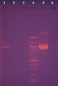 Obr. 4.15: Agarózová gelová elektroforéza PCR produktů DNA z eluátů kmenů lyofilizátů č. 1, 3 a 19 s použitím 1, 2 a 5 μl DNA matrice. Běh. č Vzorek DNA Detekce PCR matrice (μl) produktu 1.