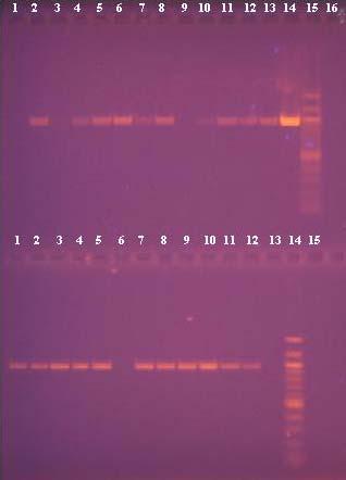 Řada 1 968bp 1500bp 1200bp Řada 2 968bp 1200bp 1000bp Řada 1 Řada 2 Běh. č DNA Detekce PCR Detekce PCR Běh.č. DNA produktu produktu 1. purif. DNA 1* - 1. purif. DNA 14* + 2. purif. DNA 2* + 2. purif. DNA 15* + 3.