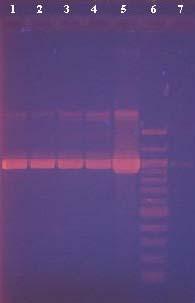 U všech vzorků došlo k vizualizaci PCR produktu s vyjímkou vzorků 1, 3, 9 a 19. Intenzita detekce PCR produktu byla výrazně nižší při použití 5 μl PCR směsi při nanášení na gel oproti nanášení 25 μl.