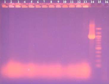 1500bp 1200bp 968bp Běh č. kolonie Detekce PCR produktu 1. vzorek č. 1-2. vzorek č. 2-3. vzorek č. 3-4. vzorek č. 4-5. vzorek č. 5-6. vzorek č. 6-7. vzorek č. 7-8. vzorek č. 8-9. vzorek č. 9-10.