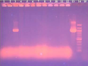 968bp 1500bp 1200bp Běh č. kolonie Detekce PCR produktu 1. vzorek č. 14-2. vzorek č. 15-3. vzorek č. 16 + 4. vzorek č. 17-5. vzorek č. 18-6. vzorek č. 19-7. vzorek č. 20-8. vzorek č. 21-9. vzorek č. 22-10.