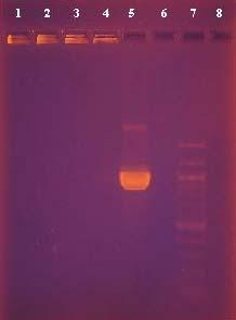 4.5.2 PCR reakce z buněk bakteriálních kolonií s přípravou DNA matrice prodlouženým povařením Z narostlých Petriho misek byla kličkou odebrán větší počet kolonií u vzorků 1, 3, 15 a 16.