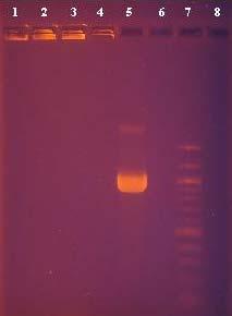 5.1 (BOIL 45 minut), ale u druhé série byly vzorky ještě 3x promyty vodou a zcentrifugovány a teprve poté se postupovalo dle kapitoly 3.5.5.1 (BOIL 45 minut). V tomto experimentu byla zvolena ještě jedna pozitivní kontrola na přítomnost inhibitorů PCR v kultivovaném médiu, kdy se jako DNA matrice použil utuhlý agar M17 s laktózou.
