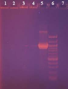 4.5.3 PCR reakce s koloniemi narostlými na Bile esculin azide agaru s použitím primerů Sterm 1 a Sterm 2 Jedna kolonie narostlá na vysoce specifickém Bile esculin azide agaru pro enterokoky byla vždy