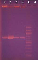 Ve všech vzorcích se amplifikoval PCR produkt o velikosti 733bp specifický pro rod Enterococcus (byla potvrzena přítomnost rodu Enterococcus ve vzorcích). 4.6.