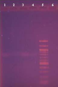 černým halo a rozsuspendována ve 20 μl PCR vody (podle kapitoly 3.5.1.4) a dále byla povařena dle programu BOIL po dobu 15 minut. PCR reakce probíhala dle programu Enterrod.