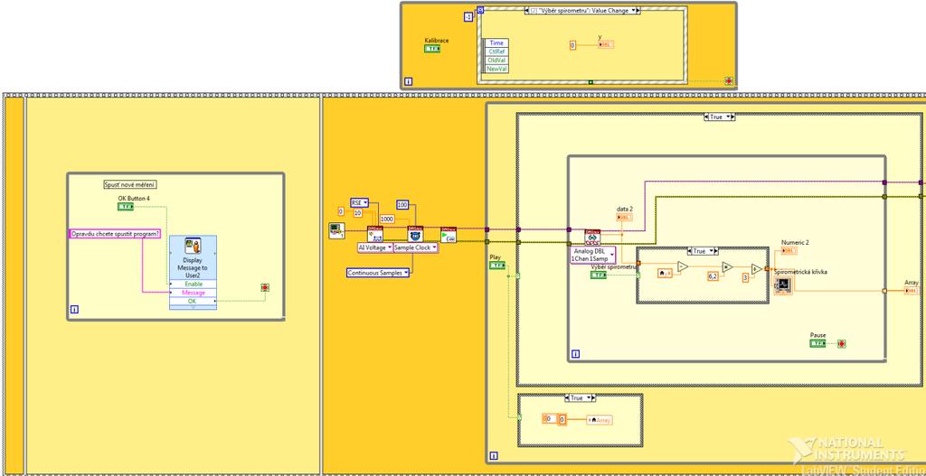 Přílohy Příloha 1: Blokový diagram softwaru pro spirometr využívající diferenciální senzor Obr.