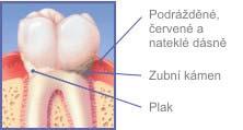 (Dotace se za poslední 3 roky snížily z jednoho a půl milionu na sto tisíc korun ročně!). Zdravé zuby jsou orientovány na všechny ročníky základní školy.