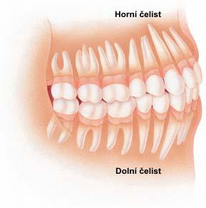 Smíš íšený chrup - je kombinace dočasných a stálých zubů v různr zném m stadiu vývoje.