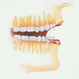 citlivost zubů - poruchy vývoje a prořez ezávání