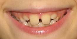Doporučen ení ortodontické léčby