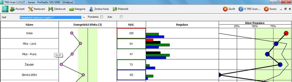 Vyšetření pomocí STRD Snímání infra záření vyzařovaného tělem pomocí bezdotykového elektronického čidla. Informace z čidla se automaticky ukládají do počítače a matematicky zpracovávají.