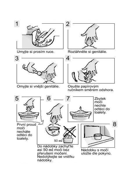 strana : 15 z 26 Nejčastěji používaný vzorek moče je střední proud moče. Odběr středního proudu moče - ženy Umyjte si ruce mýdlem a vodou a osušte je. Vezměte nádobku na odběr moče na toaletu.