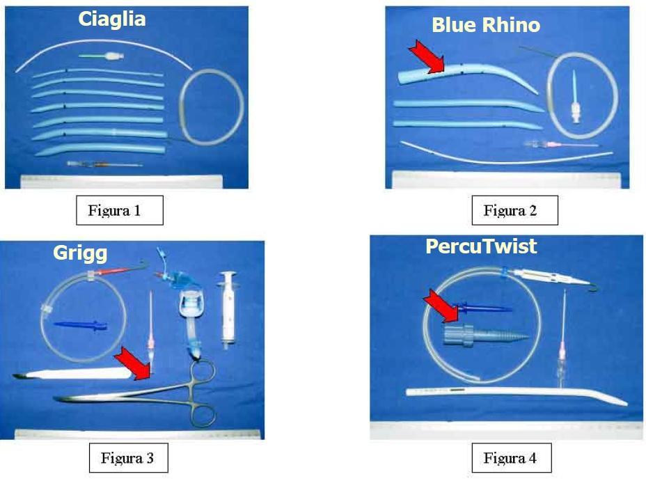 PŘÍLOHY Příloha č 1 Punkční dilatační tracheostomie Zdroj: Intensive Care Medicine.