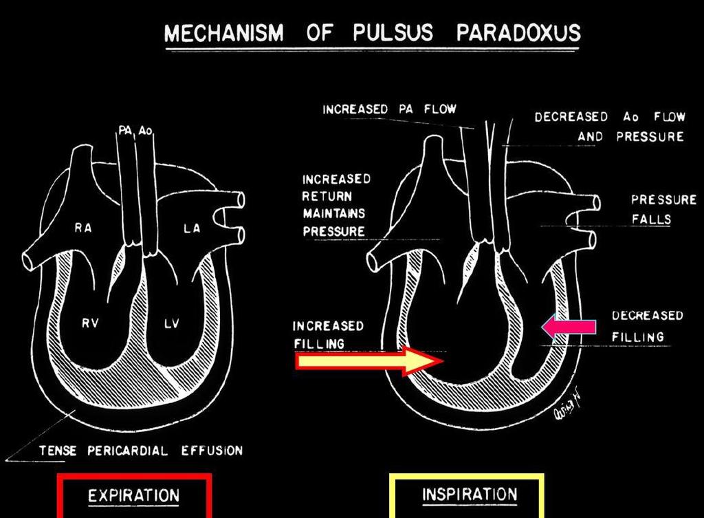 Pulsus