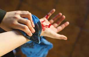 Abychom zabránili kontaktu s krví cizího člověka, používáme gumové rukavice. Masivní vnější krvácení Nejnebezpečnější druh krvácení.