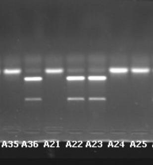 Genotypové metody průkazu schopnosti tvořit biofilm detekce genů kódujících tvorbu biofilmu Průkaz ica operonu u