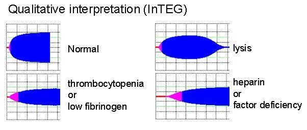 TEG/ROTEM + Zohledňuje pevnost koagula, množství a funkci destiček, množství fibrinogenu i aktivitu fibrinolýzy + + - Point of care test (nečekáme na