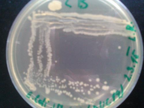 5.2 Izolace a gelová elektroforéza pdna Obrázek č. 6 LB agar kultura E. coli JM 109 (puc 19) Z 1 ml kultury E.