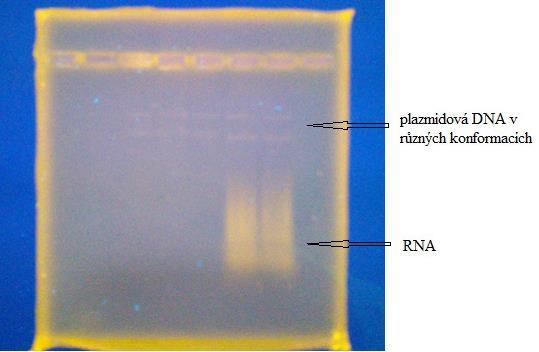 Na gelu byla detegována plazmidová DNA ve dvou formách a RNA. 5.